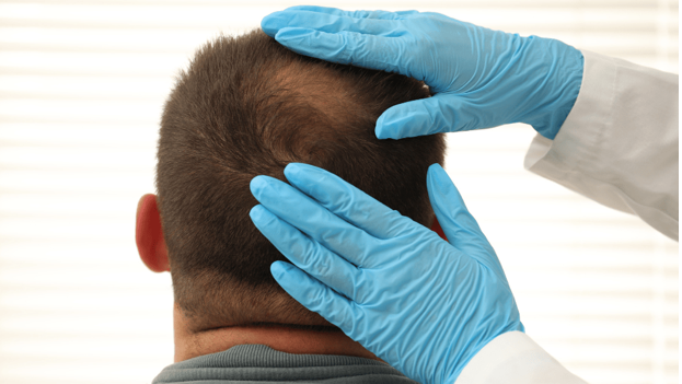 PRP Hair Treatment in London: Comparing Your Options in 2026